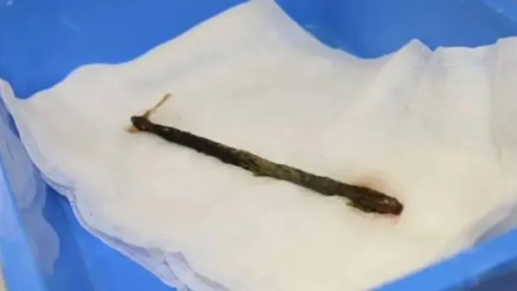 Талдықорғанда құтқарушылар суда аяғына арматура кіріп кеткен балаға көмектесті