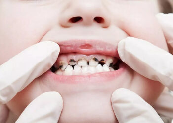 Балалардың тісі неге әлсіз?