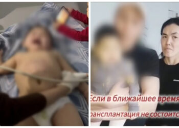 Талдықорғанда жансақтау бөліміне түскен баланың анасы тұрмыстық зорлық-зомбылықтың құрбаны екенін айтты