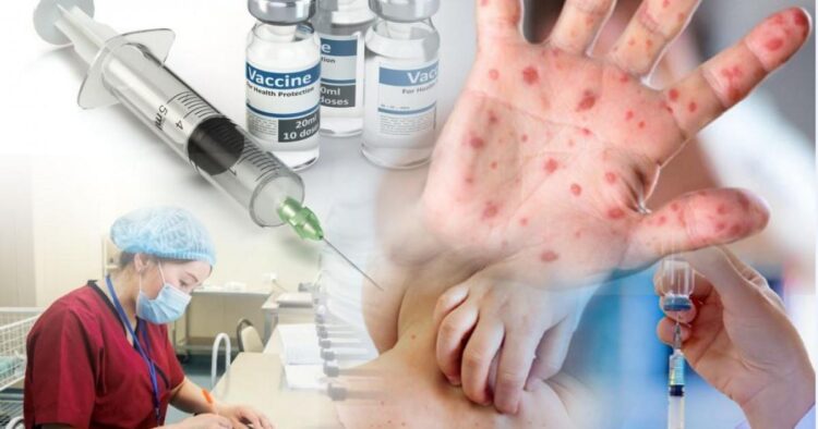 Қызылша өршіп тұр: Денсаулық сақтау министрлігі шұғыл шараларды қолға алды