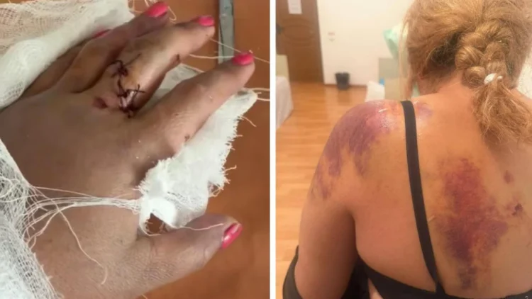 Ақсу ауданында қылмыстық іс: әйелге шабуыл жасалды