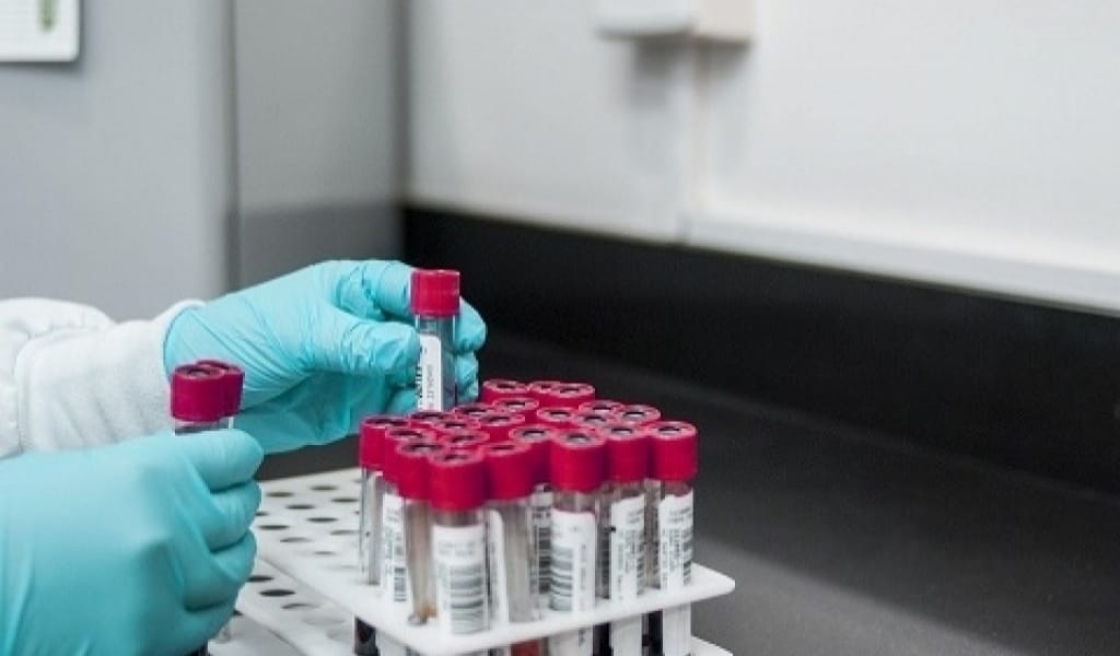 АЛМАТЫ ОБЛЫСЫНДА ЕКІ ТӘУЛІК ІШІНДЕ 135 АДАМ ІНДЕТ ЖҰҚТЫРДЫ