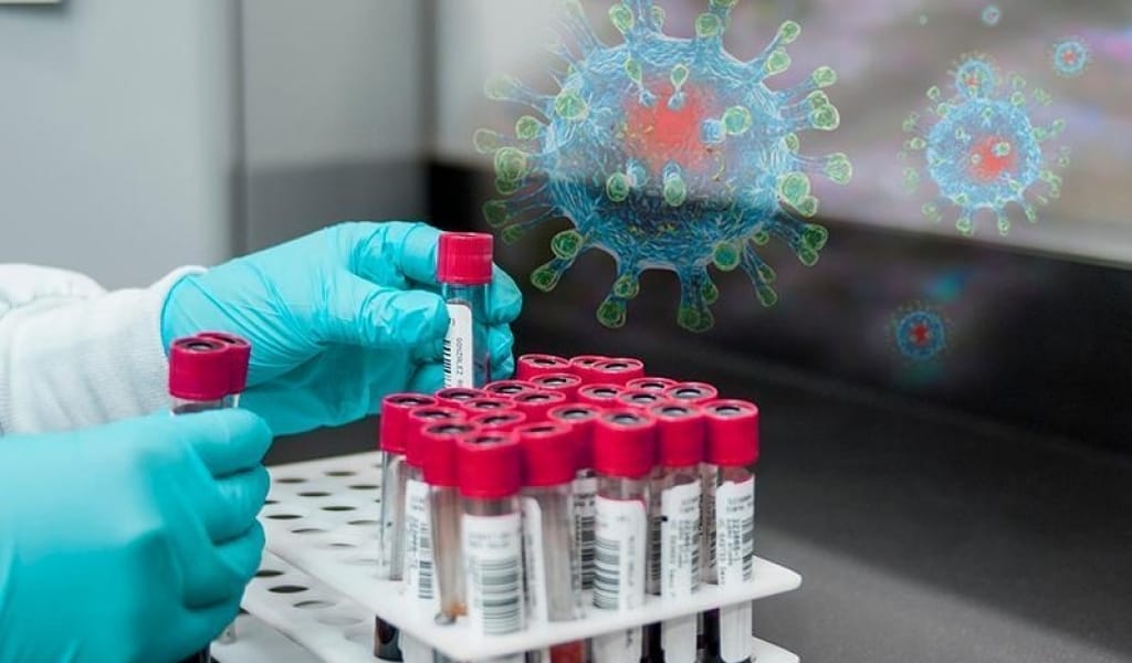 ҮКІМЕТ БАСШЫСЫ: "КОВИДКЕ ҚАРСЫ ЕКПЕ САЛДЫРУ ӘР АДАМНЫҢ ӨЗ ЕРКІНДЕ"