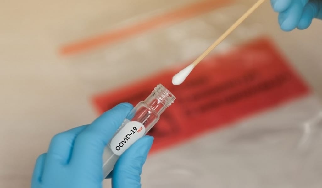 АЛМАТЫ ОБЛЫСЫНЫҢ ҮШ ЕЛДІ МЕКЕНІНДЕ КОРОНАВИРУС ӨРШІП ТҰР