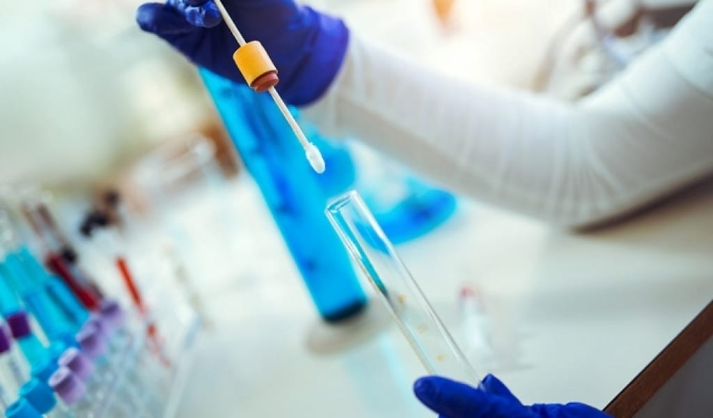 АЛМАТЫ ОБЛЫСЫНДА БІР КҮНДЕ 10 АДАМ ПНЕВМОНИЯҒА ШАЛДЫҚТЫ