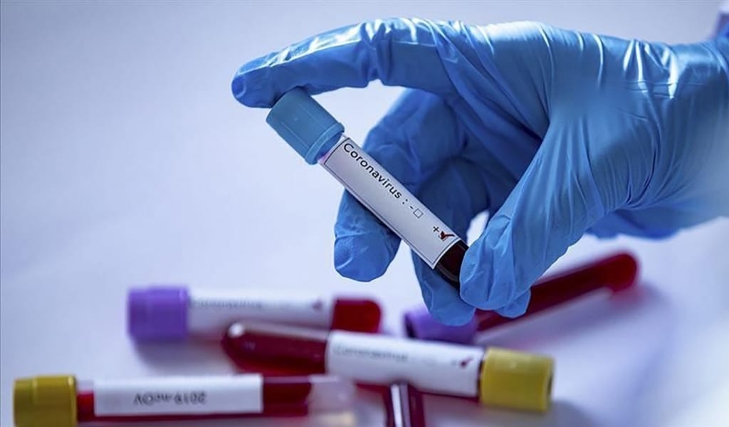 ЖАМБЫЛ АУДАНЫНЫҢ АУРУХАНАСЫ КОВИДКЕ ҚАРСЫ ДӘРІ-ДӘРМЕКПЕН ТОЛЫҚТЫ