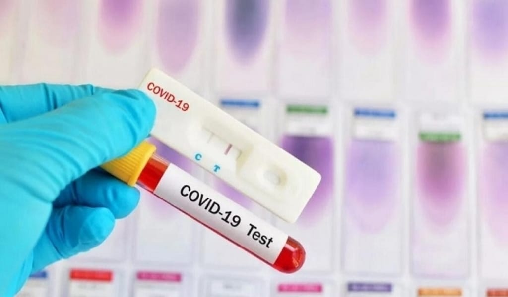 АЛМАТЫ ОБЛЫСЫНДА ІНДЕТ ЖҰҚТЫРУШЫЛАР САНЫ АЗАЙДЫ: ӘКІМДІКТЕГІ ЖИЫН