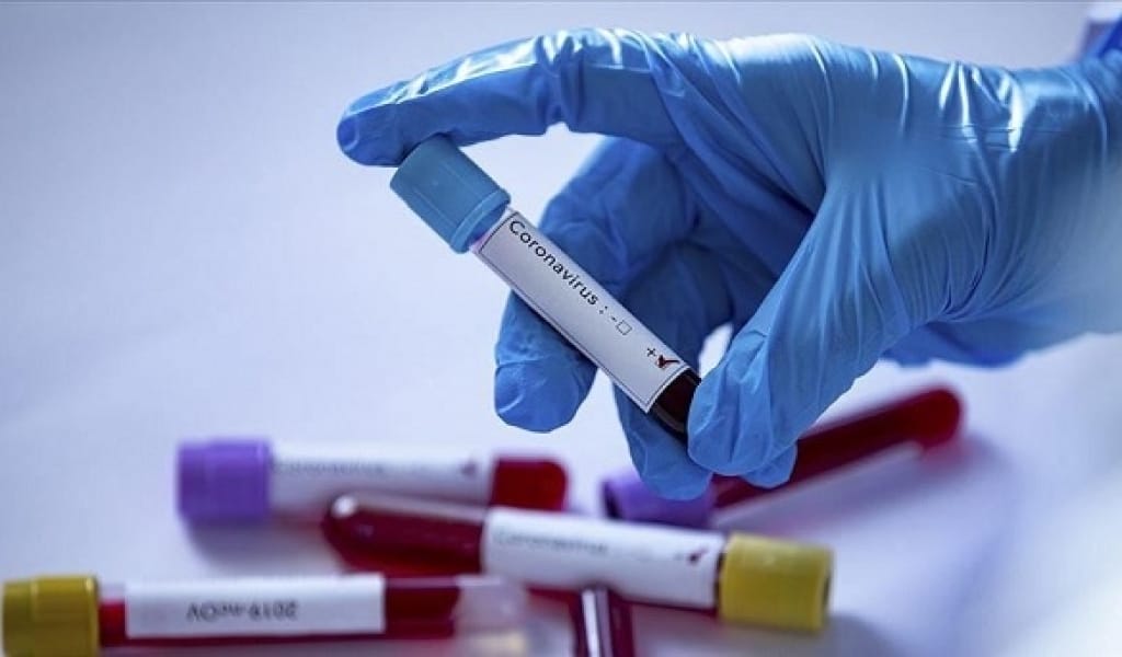 АЛМАТЫ ОБЛЫСЫНДА ІНДЕТ ЖҰҚТЫРҒАН 48 АДАМНЫҢ ЖАҒДАЙЫ АУЫР