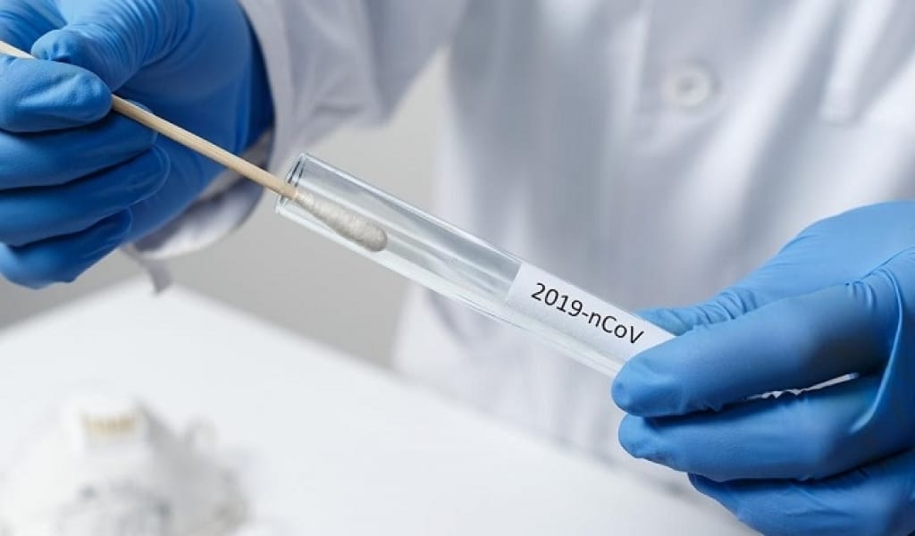 АЛМАТЫ ОБЛЫСЫНДА БІР КҮНДЕ 166 АДАМНАН ҚАУІПТІ ІНДЕТ АНЫҚТАЛДЫ