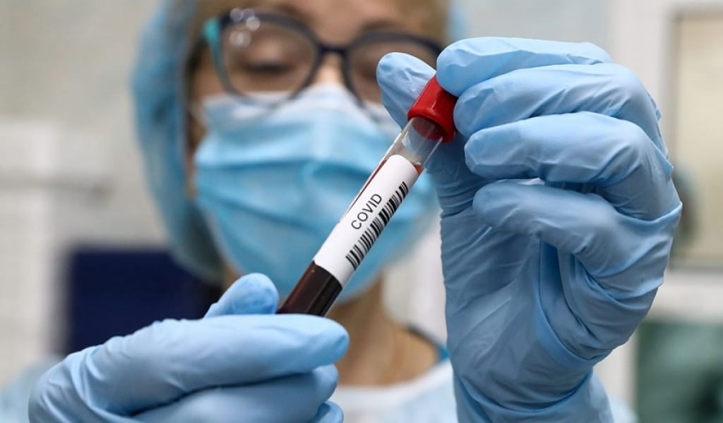 КЕШЕ ТАЛДЫҚОРҒАН МЕН ІЛЕ АУДАНЫНДА КОРОНАВИРУС КӨП ТІРКЕЛДІ