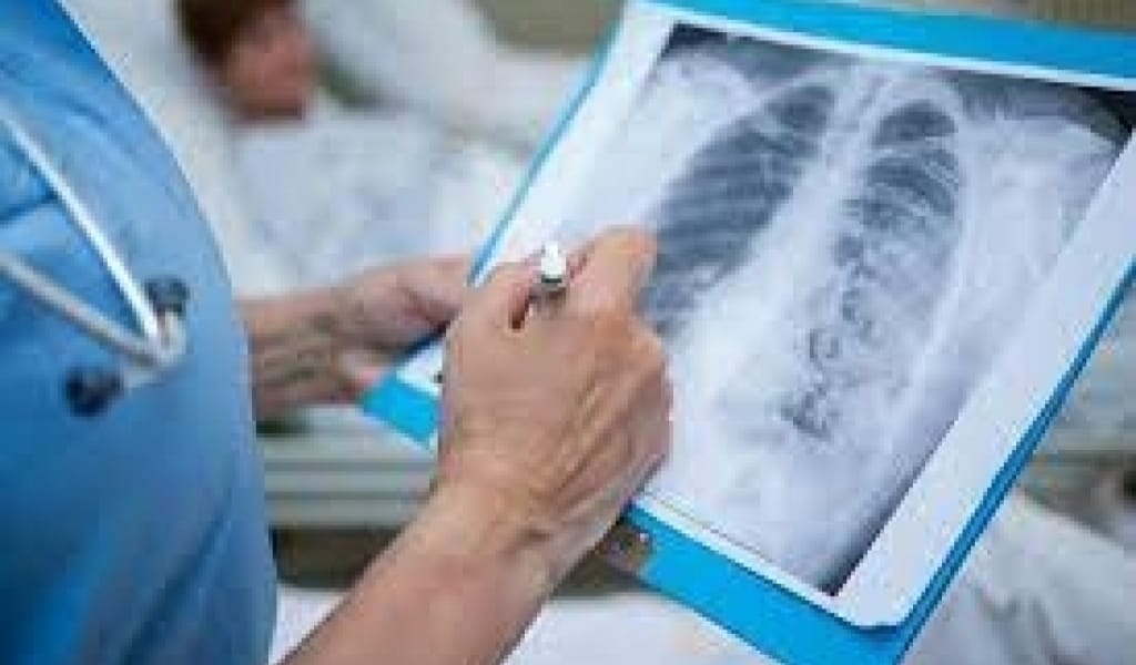 АЛМАТЫ ОБЛЫСЫНДА БҮГІН 300 АДАМНАН КОРОНАВИРУС АНЫҚТАЛДЫ