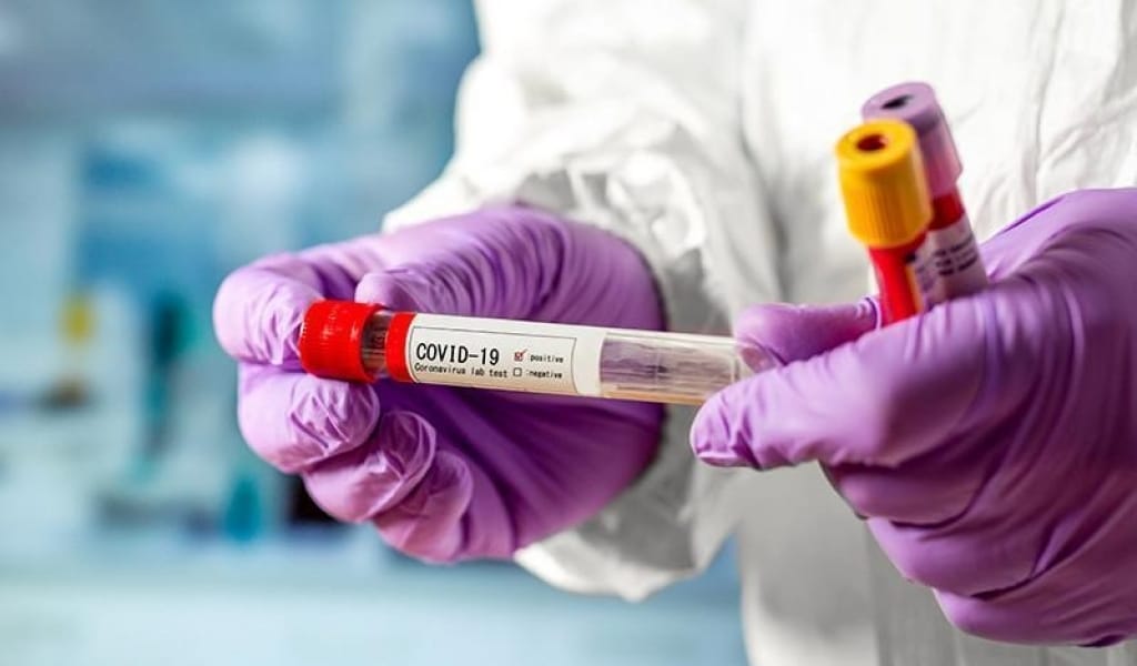 БІР КҮНДЕ 222 АДАМ АУРУХАНАҒА ТҮСТІ: АЛМАТЫ ОБЛЫСЫ ӘЛІ "ҚЫЗЫЛ АЙМАҚТА"