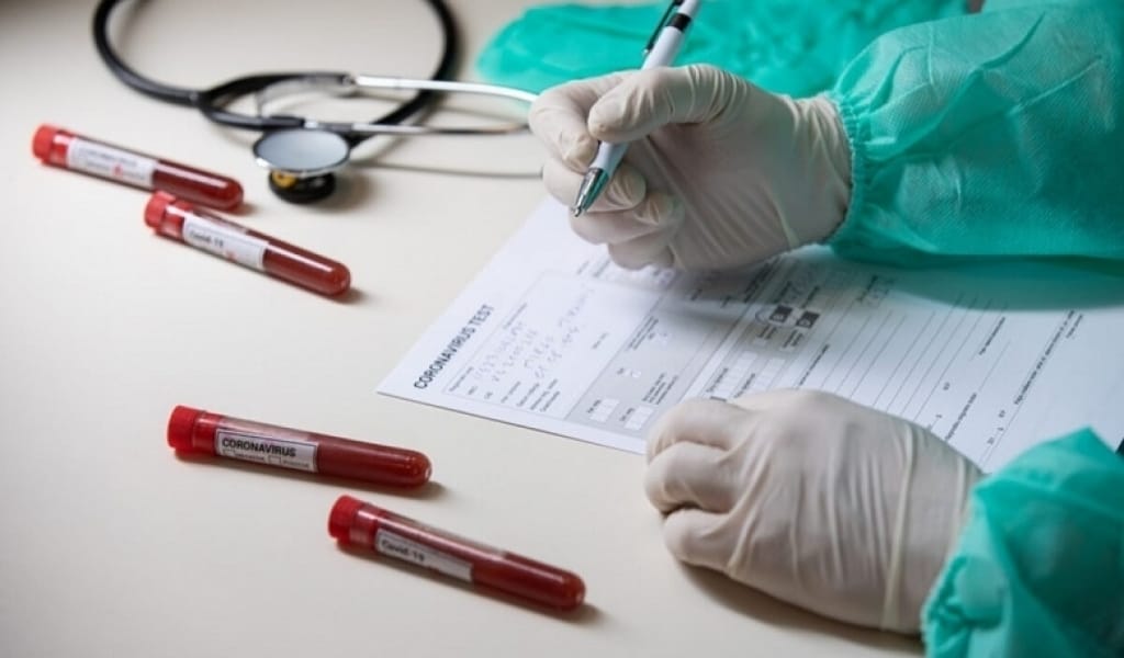 БІР КҮНДЕ 606 АДАМ ІНДЕТТЕН АЙЫҚТЫ: АЛМАТЫ ОБЛЫСЫ "САРЫ АЙМАҚТА"