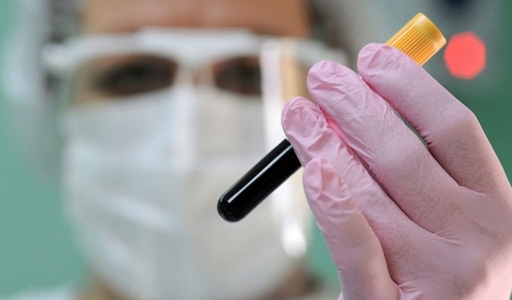 ТҮРЛЕНГЕН ОМИКРОН ШТАМЫ ШАШ АРҚЫЛЫ ТАРАЙ МА? ДӘРІГЕРДІҢ ЖАУАБЫ