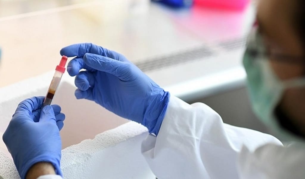 КОРОНАВИРУС ЖҰҚТЫРҒАН 16 НАУҚАС ЖАНСАҚТАУ БӨЛІМІНДЕ ЖАТЫР