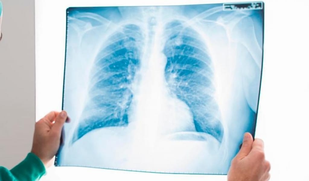 БҮГІН 15 БАЛАДАН КОРОНАВИРУС АНЫҚТАЛДЫ - ОБЛЫСТАҒЫ ЭПИДАХУАЛ