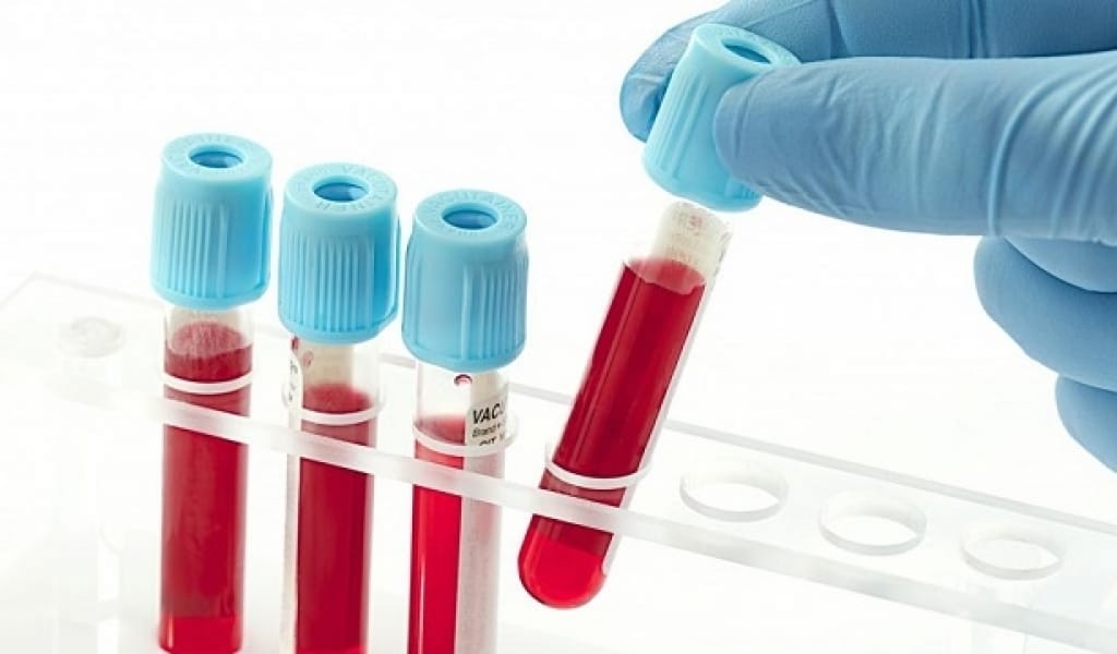 ҚАН АУРУЫНА ШАЛДЫҚҚАН БАЛАЛАРҒА ЕМ-ДОМ УАҚЫТЫЛЫ ЖҮРГІЗІЛЕДІ