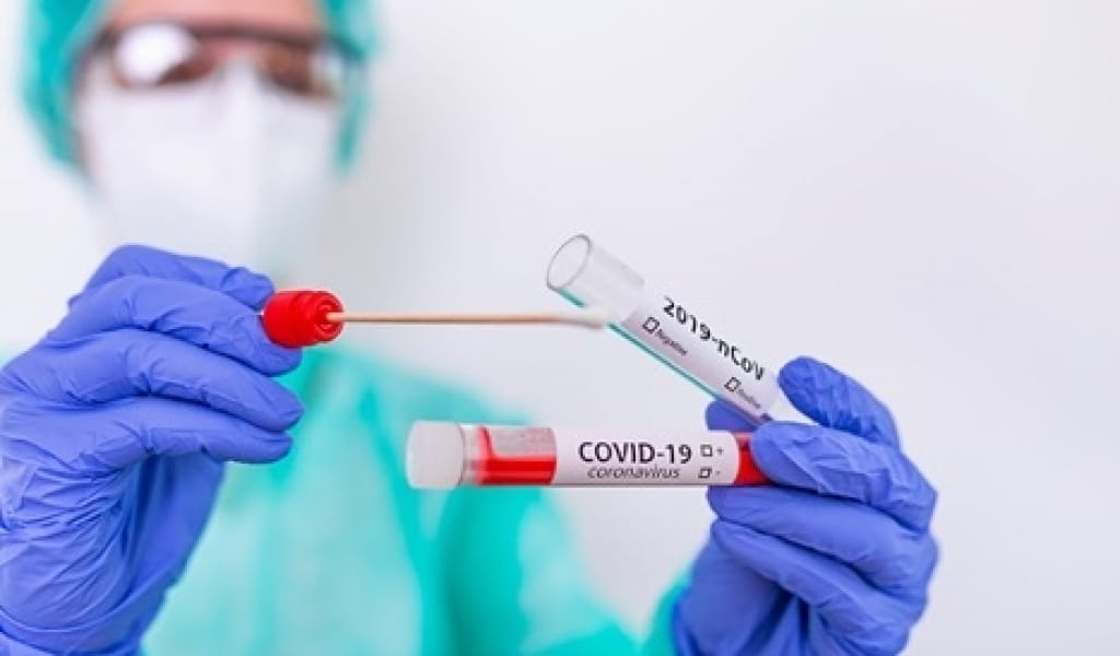 БІР АПТАДА 175 АДАМНАН КОРОНАВИРУС АНЫҚТАЛДЫ. ЭПИДАХУАЛ КҮРДЕЛІ