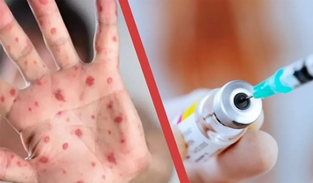 Талдықорғанда қызылшамен ауырғандар саны 150-ге жетті