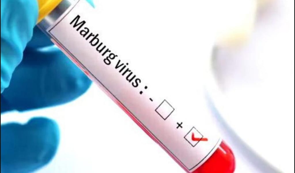 МАРБУР ВИРУСЫНА БАЙЛАНЫСТЫ БАҚЫЛАУ КҮШЕЙДІ