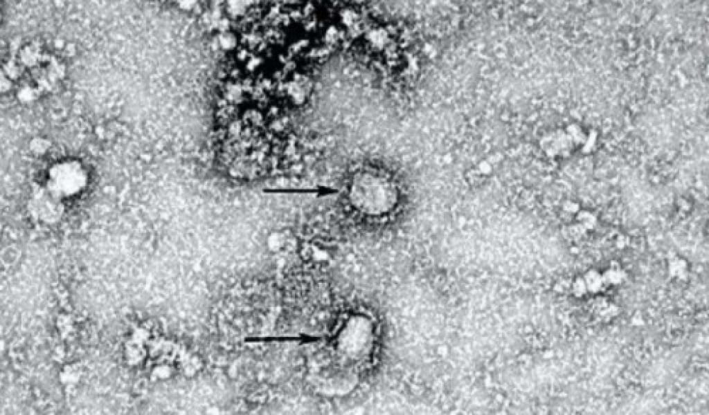 "УАҚЫТ КЕРЕК": ҚЫТАЙДА ТАРАҒАН ВИРУСТЫҢ ЕМІ ТАБЫЛДЫ