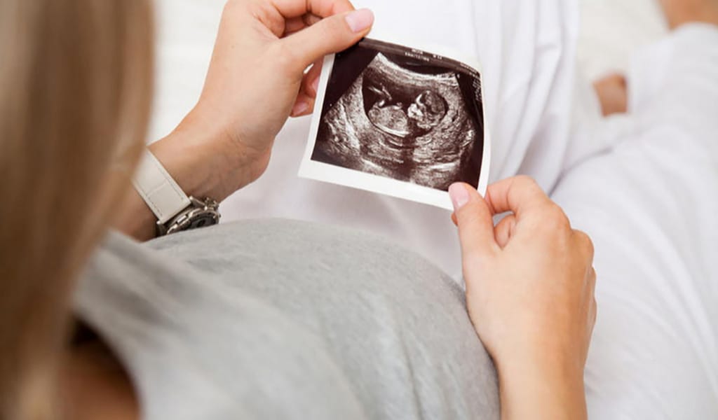 КОРОНАВИРУС: АЛМАТЫ ОБЛЫСЫНДА ЖҮКТІ ӘЙЕЛДЕРГЕ ЖЕҢІЛДІК ЖАСАЛДЫ