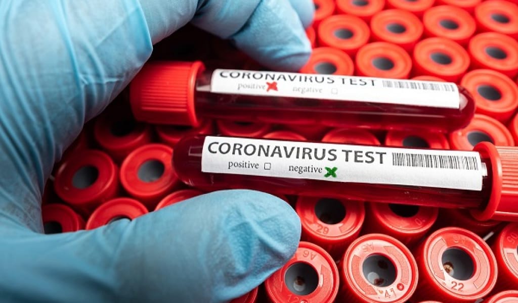 КОРОНАВИРУС: КӨЗ ЖҰМҒАН ӘЙЕЛМЕН БАЙЛАНЫСТА БОЛҒАНДАР АНЫҚТАЛДЫ