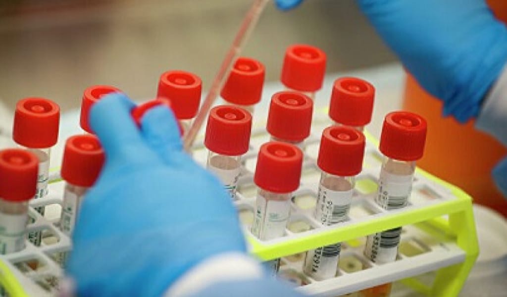 ШҰҒЫЛ: АЛМАТЫ ОБЛЫСЫНДА ЖҮКТІ ӘЙЕЛ КОРОНАВИРУС ЖҰҚТЫРДЫ