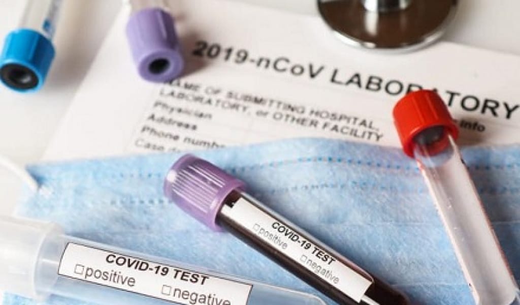 "ВИРУС ЖОҚ": ДУБАЙ АЙМАҒЫНАН КЕЛГЕН 43 АДАМНЫҢ ҚАН САРАПТАМАСЫ ШЫҚТЫ