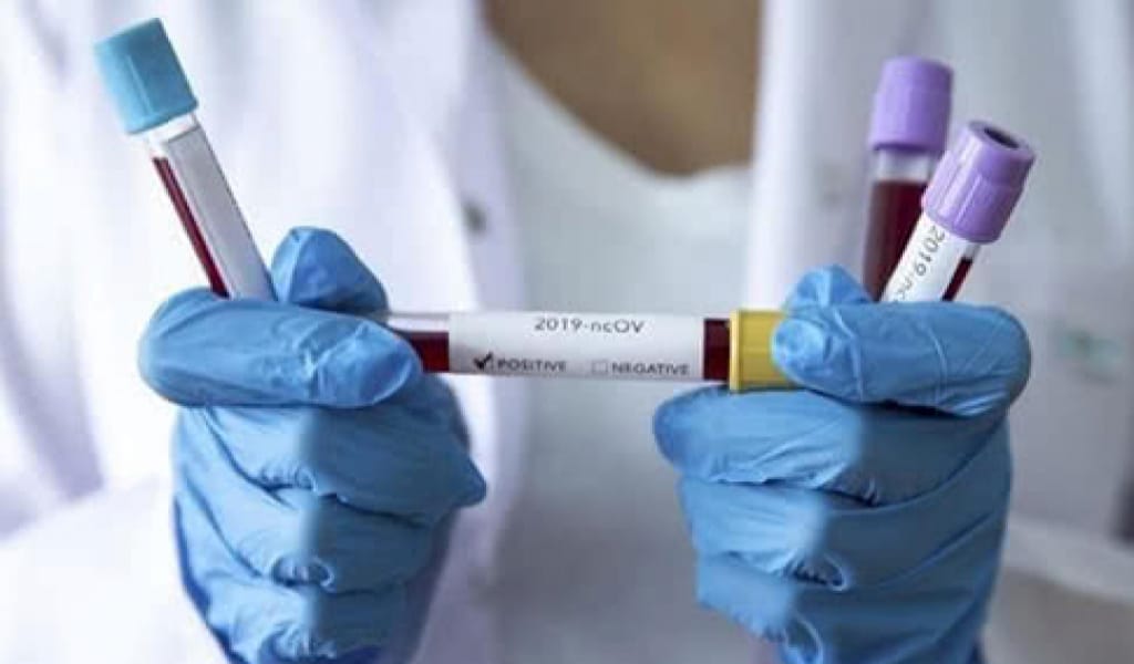 КОРОНАВИРУСТАН ЕМДЕЛІП ШЫҚҚАН ТӨРТ ТҰРҒЫН ҮЙЛЕРІНЕ ҚАЙТТЫ