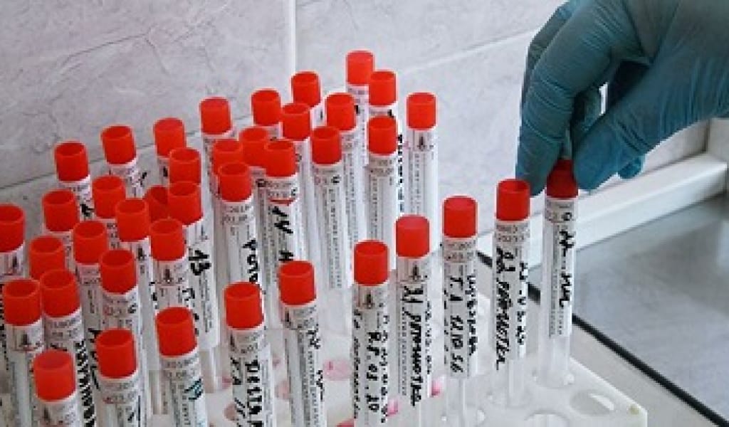 "ЕҢ КІШІСІ ҮШ ЖАСТА": КЕРБҰЛАҚ АУДАНЫНДА ТАҒЫ 5 АДАМ КОРОНАВИРУС ЖҰҚТЫРДЫ