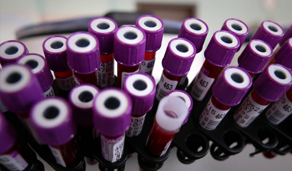 ҚАЗАҚСТАНДА ТӨРТ ТАНЫМАЛ ТҰЛҒА КОРОНАВИРУСПЕН АУРУХАНАҒА ТҮСТІ