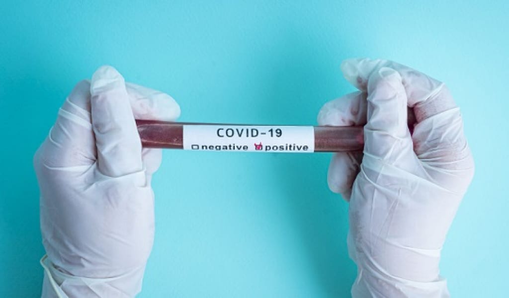 "БУЫНДАРЫ АУЫРҒАН": АЛМАТЫ ОБЛЫСЫНДА ТАҒЫ 8 АДАМ КОРОНАВИРУСПЕН ЖАТҚЫЗЫЛДЫ