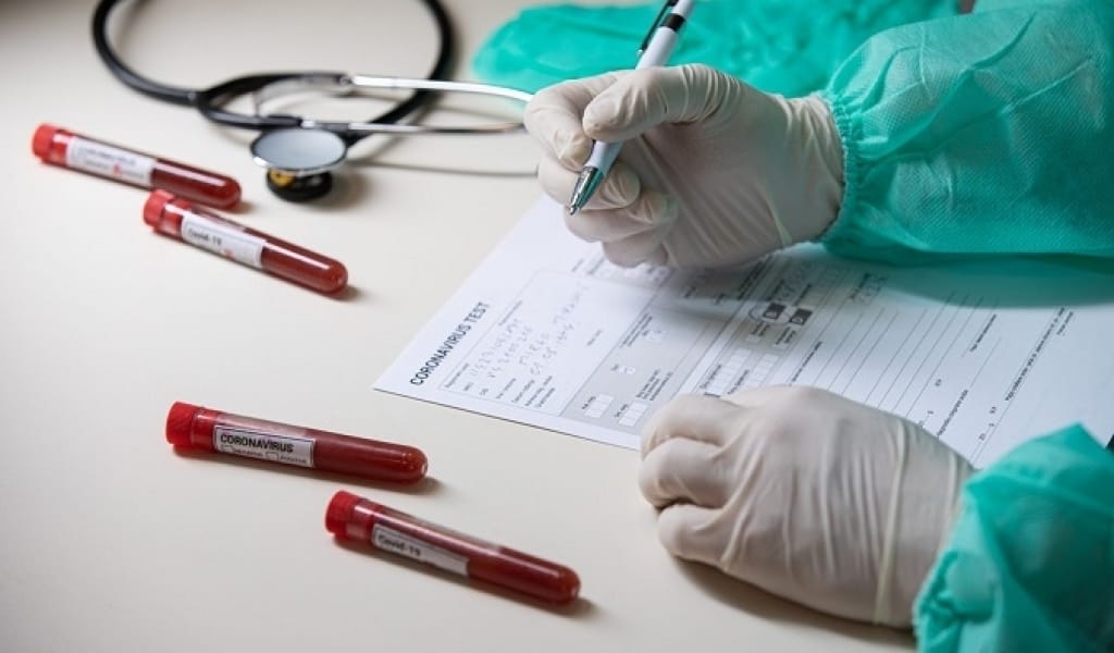 ВИЦЕ-МИНИСТР: "КОРОНАВИРУСТАН ЕМДЕУ ӘДІСІНЕ ӨЗГЕРІСТЕР ЕНГІЗІЛДІ"