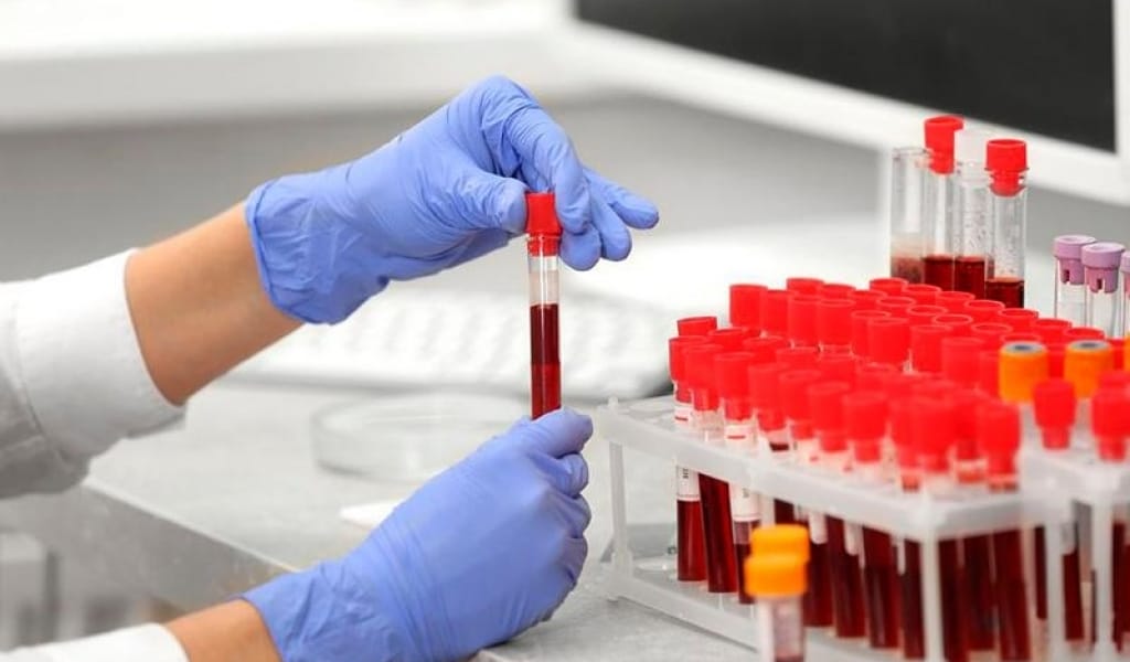 КОРОНАВИРУС БОЙЫНША ЖАҢА СТАТИСТИКА: АРТЫҚШЫЛЫҒЫ НЕДЕ?