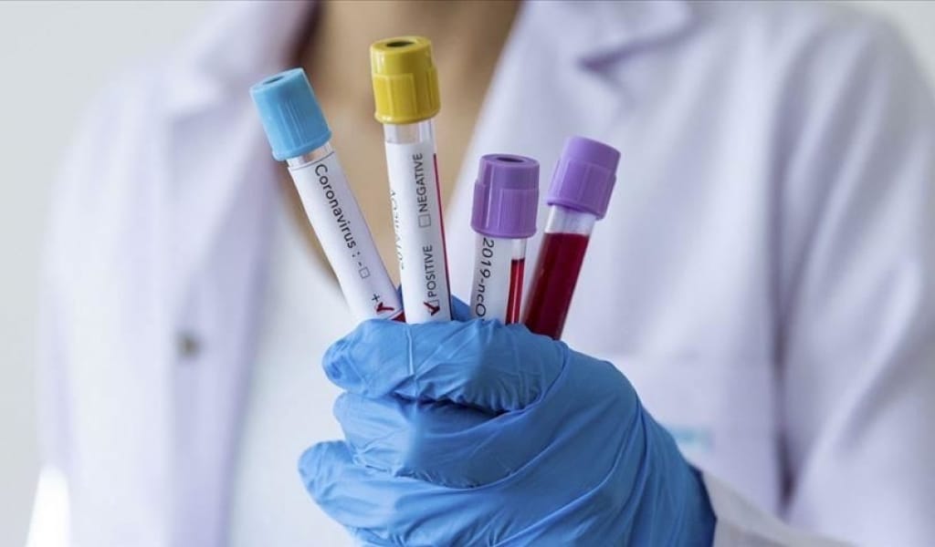 АЛМАТЫ ОБЛЫСЫНДА КОРОНАВИРУСПЕН КҮРЕС ЖҰМЫСЫ КҮШЕЙТІЛЕДІ