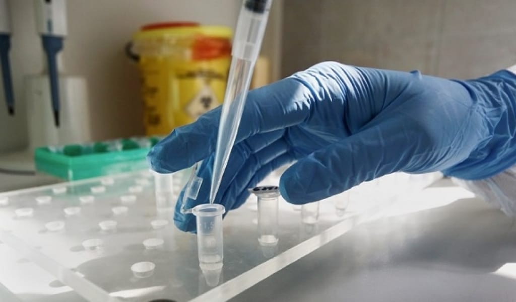 АЛМАТЫ ОБЛЫСЫНДА КОВИДТІ АНЫҚТАЙТЫН 10 ЗЕРТХАНА ЖҰМЫС ІСТЕЙДІ