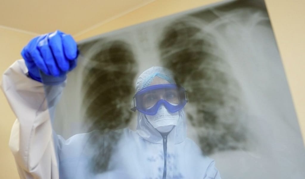 АЛМАТЫ ОБЛЫСЫНДА 79 АДАМ КОРОНАВИРУСТАН ҚАЙТЫС БОЛДЫ